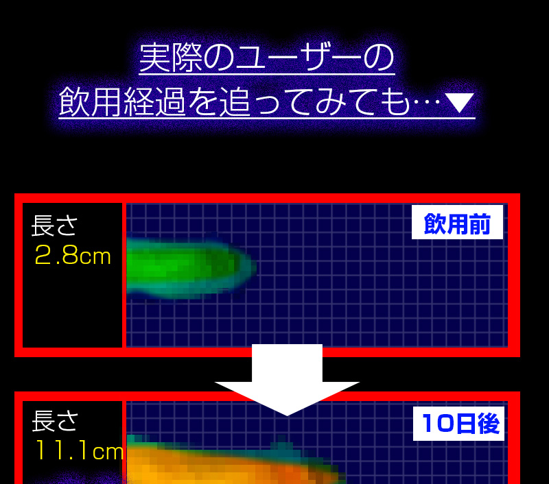 黒蟻Ｘ錠